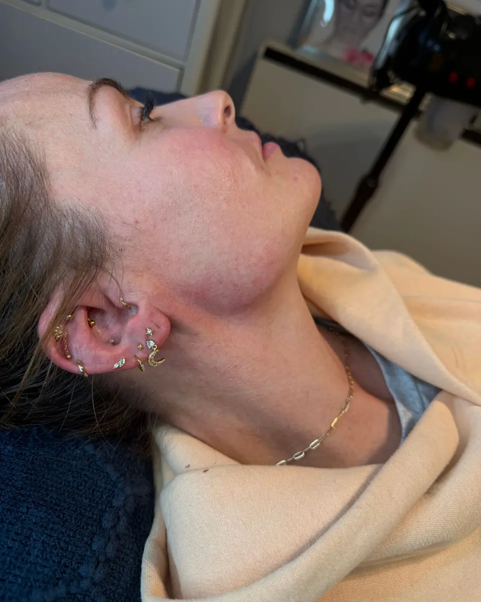 Side profile of a client relaxing on the treatment couch