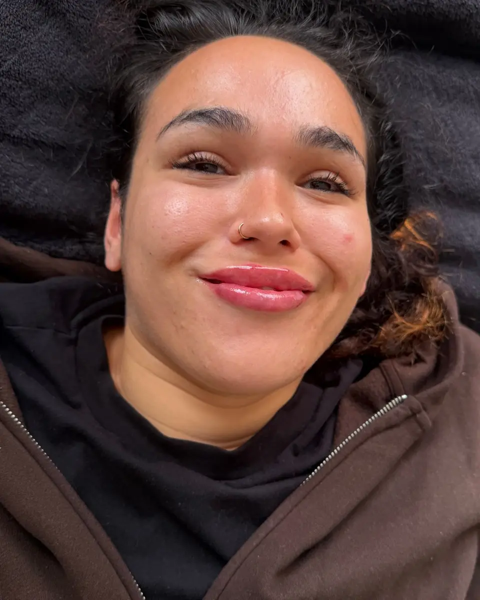 Smiling client with full, glossy pink lips, relaxing on the treatment couch